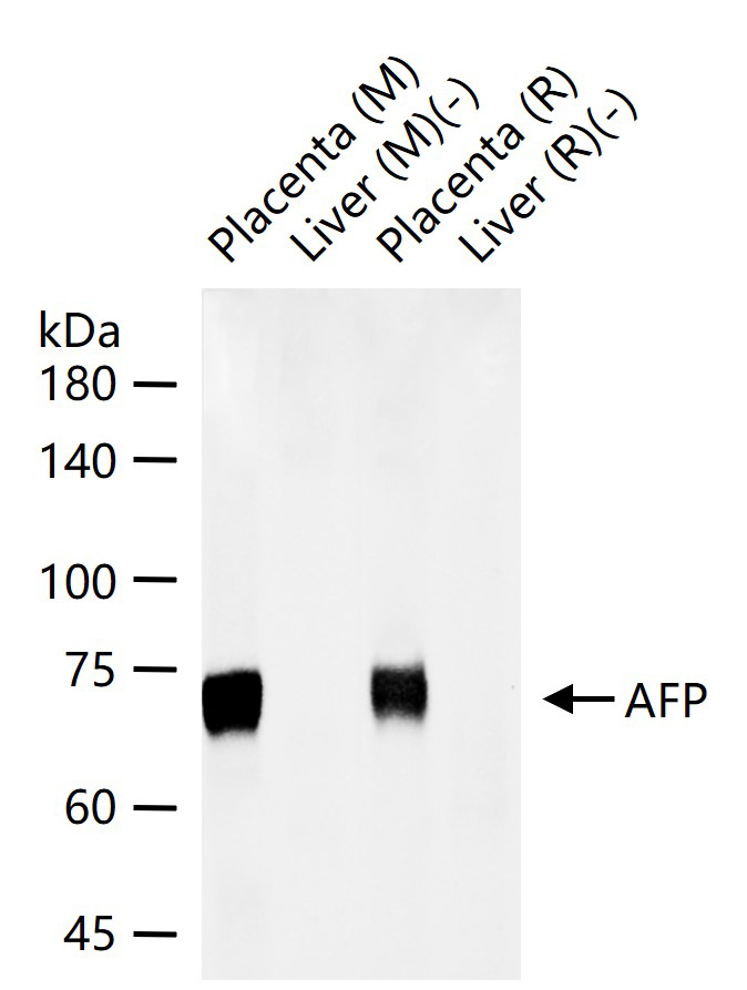 AFP(A2) Mouse mAb (一抗) - WB,IHC-P,IHC-F,IF,ELISA | Bioss