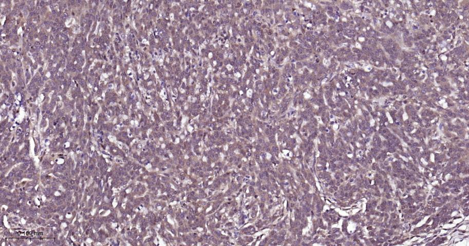 信号转导和转录激活因子5重组兔单抗