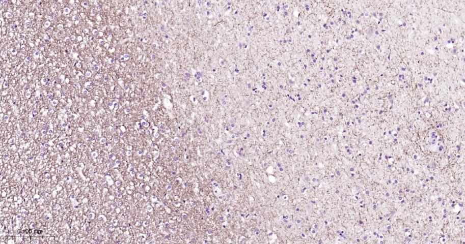 微管蛋白γ重组兔单抗