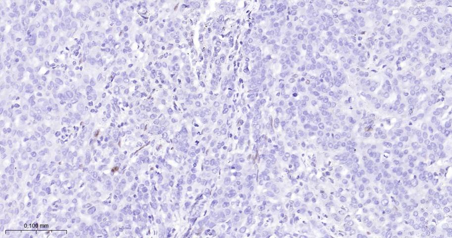 负调控因子白细胞介素2重组兔单抗