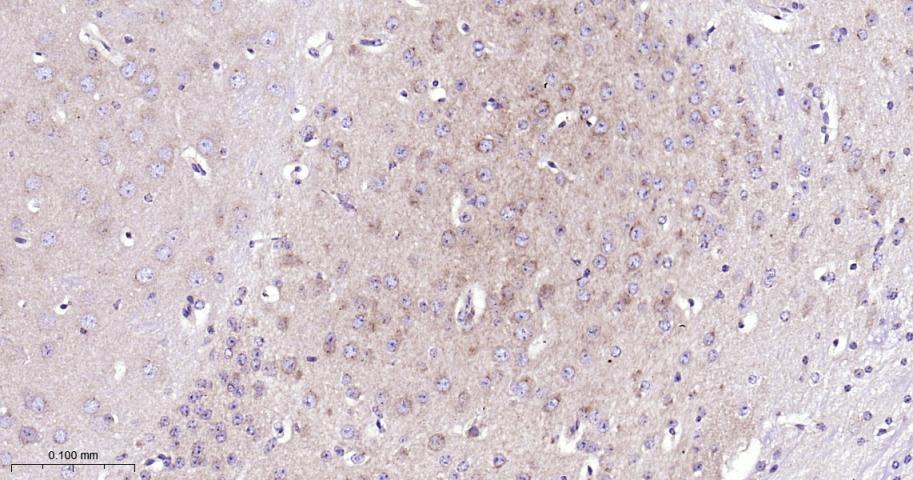 微管蛋白γ重组兔单抗