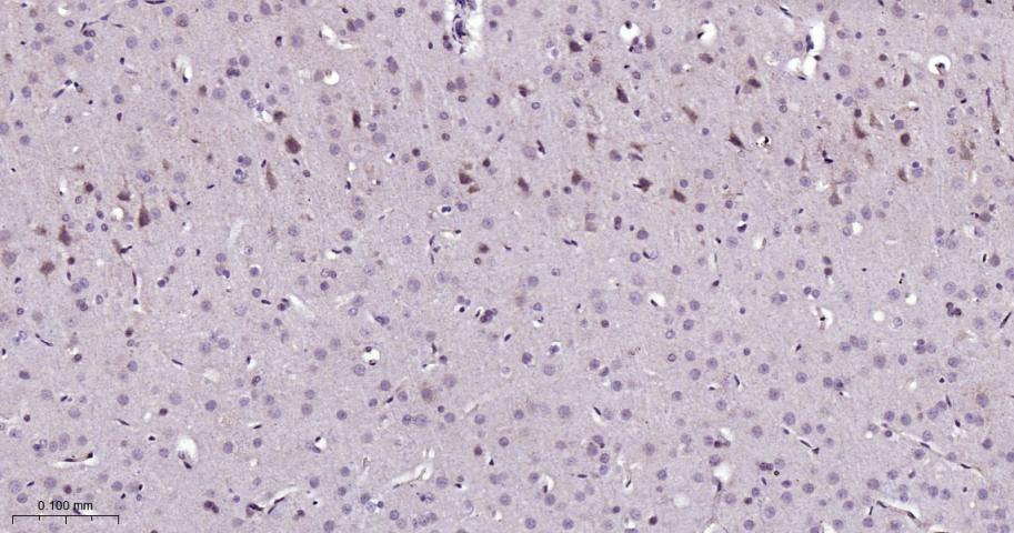 信号转导和转录激活因子5重组兔单抗