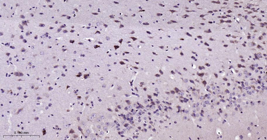 信号转导和转录激活因子5重组兔单抗