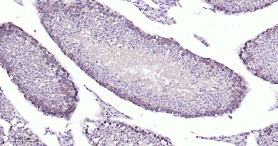 微管蛋白γ重组兔单抗