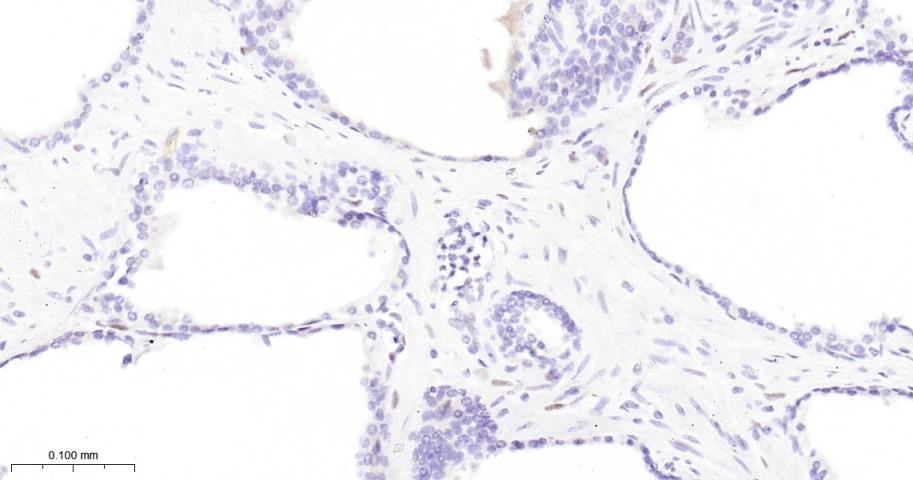 负调控因子白细胞介素2重组兔单抗