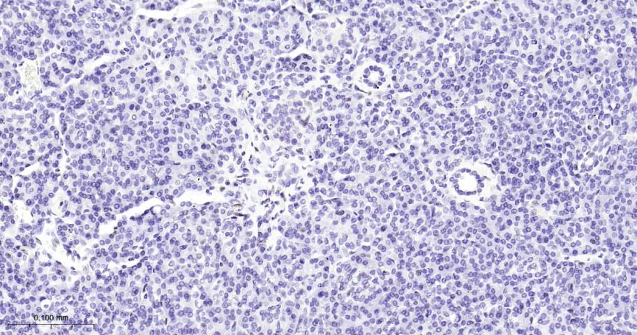 负调控因子白细胞介素2重组兔单抗