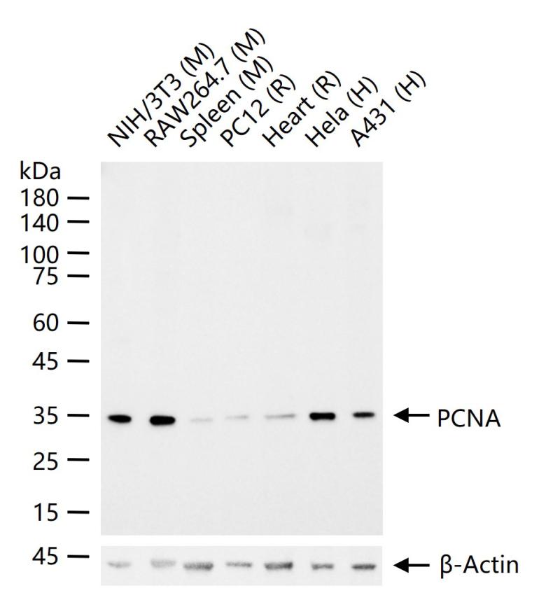 增殖细胞核抗原（核内参）重组兔单抗