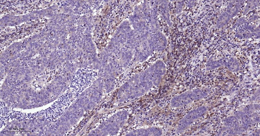 信号转导和转录激活因子5重组兔单抗