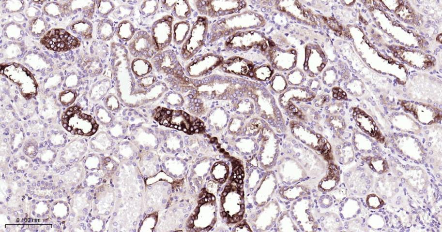 微管蛋白γ重组兔单抗