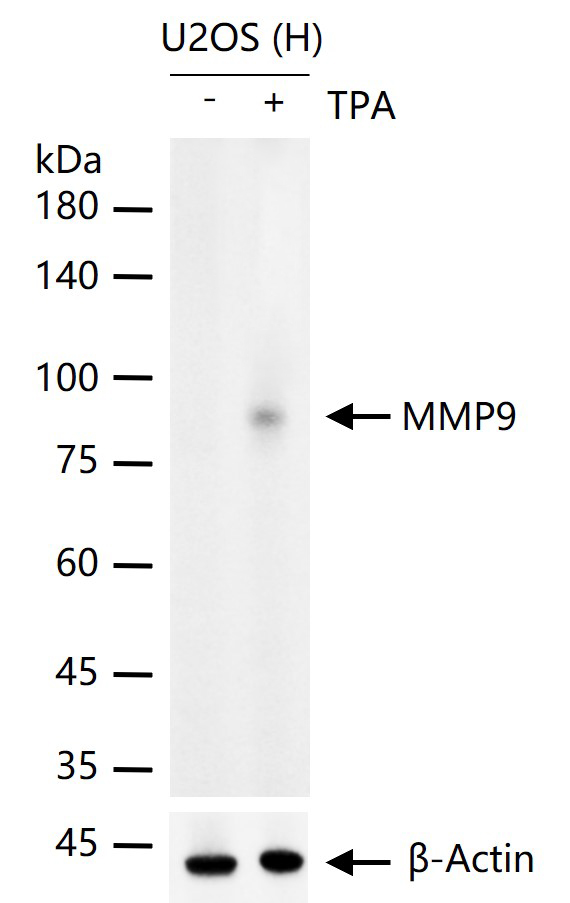 基质金属蛋白酶-9重组兔单抗