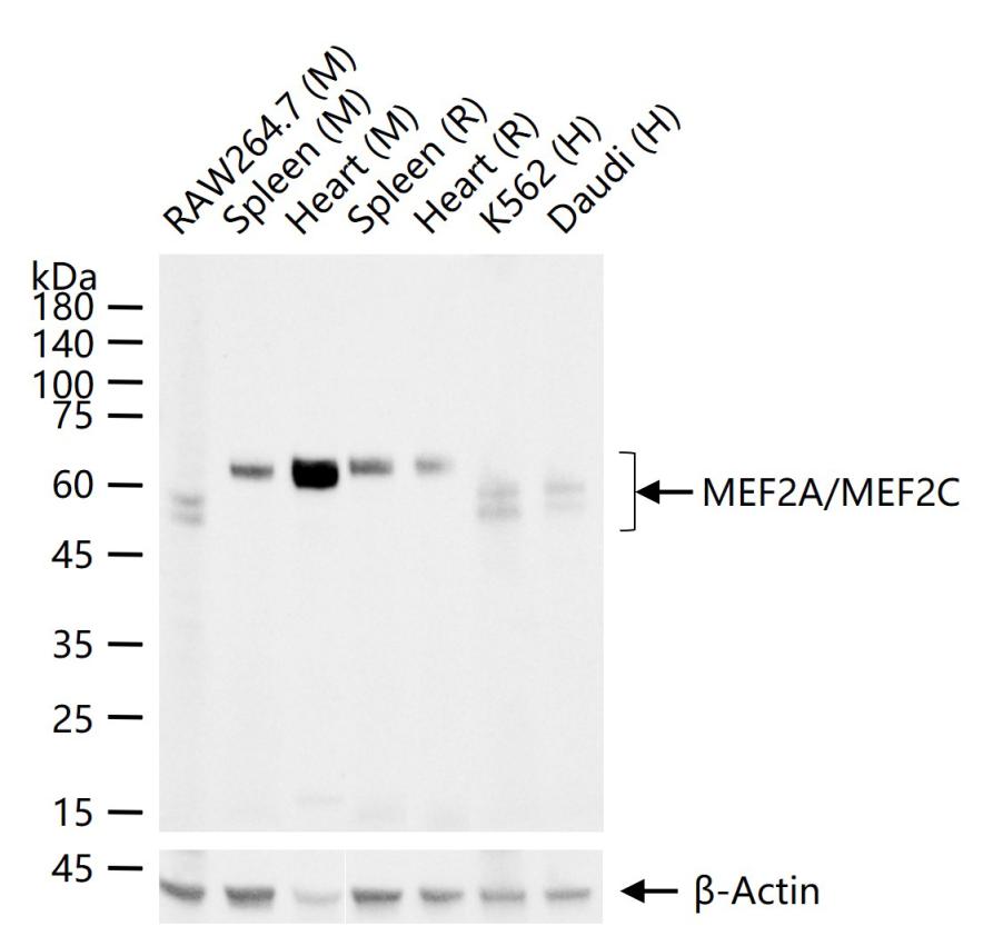 肌细胞增强因子2A/2C重组兔单抗
