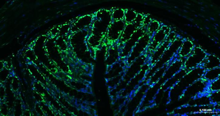 组蛋白H3(核内参)单克隆抗体-bsm-33042M