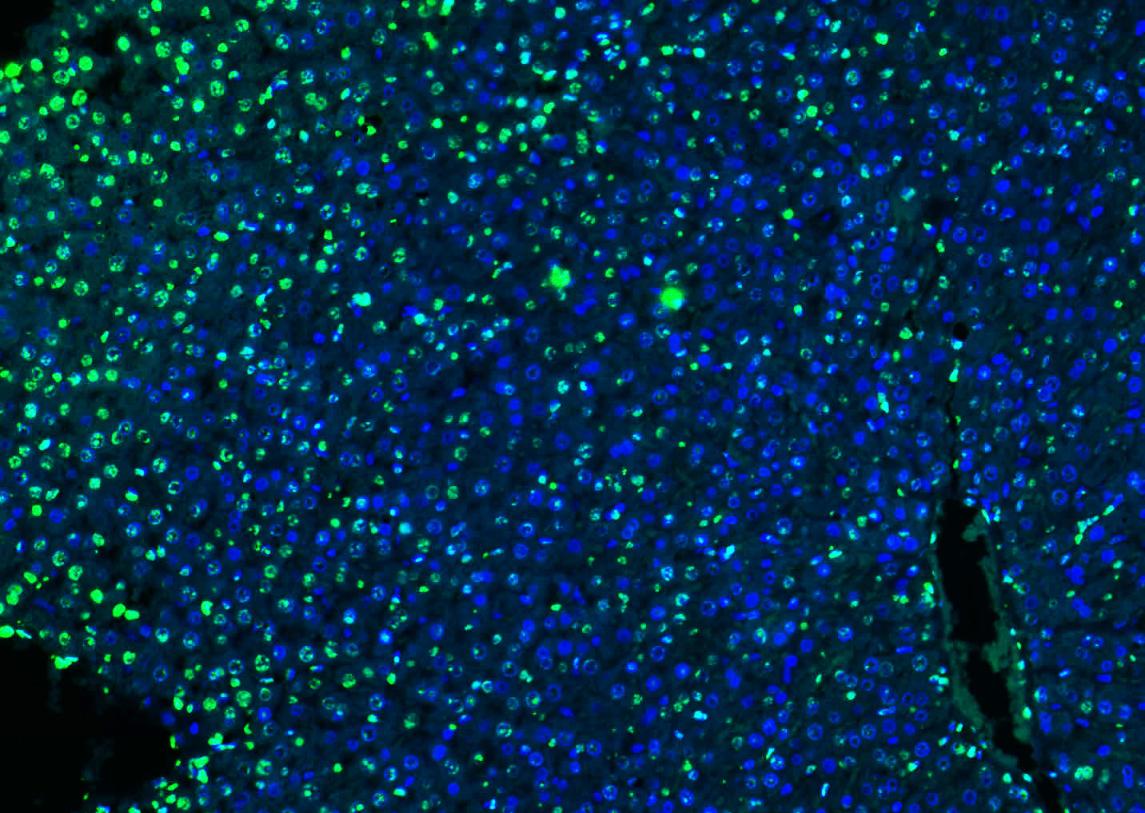 组蛋白H3（核内参）抗体-bs-0349R