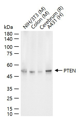 一种肿瘤抑制基因抗体