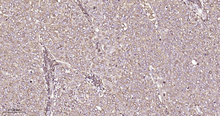 蛋白质二硫键异构酶重组兔单抗