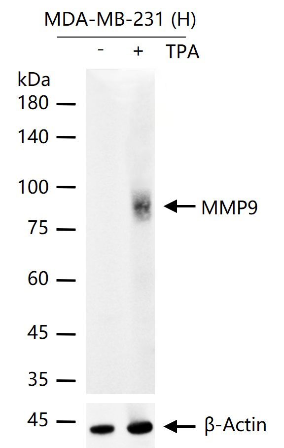 基质金属蛋白酶-9重组兔单抗