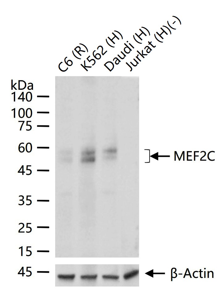 肌细胞增强因子2C重组兔单抗