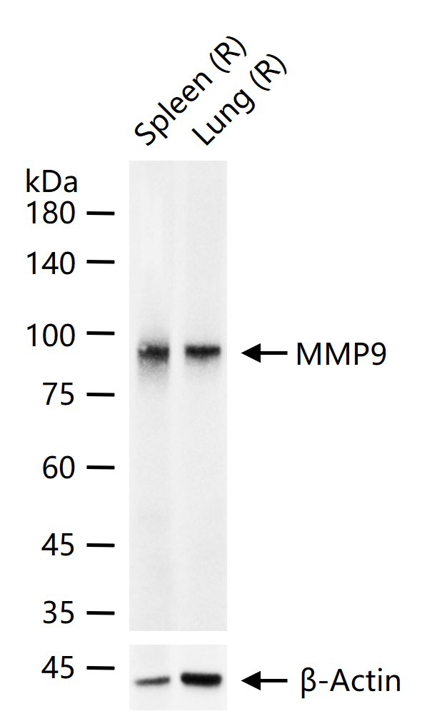 基质金属蛋白酶-9重组兔单抗