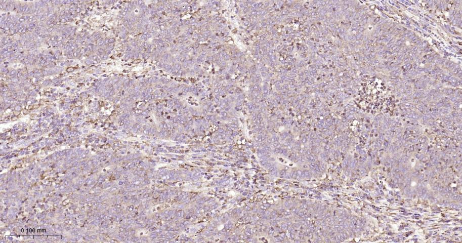 蛋白质二硫键异构酶重组兔单抗