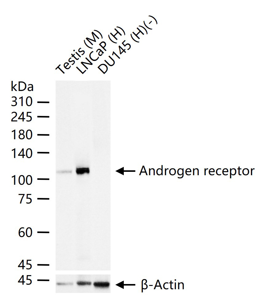 雄激素受体重组兔单抗