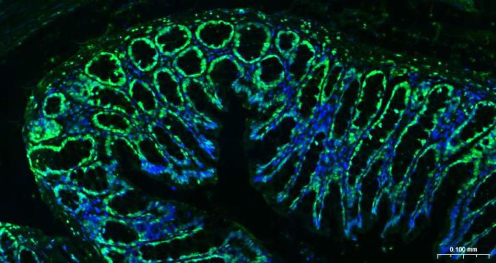 组蛋白H3(核内参)单克隆抗体-bsm-33042M