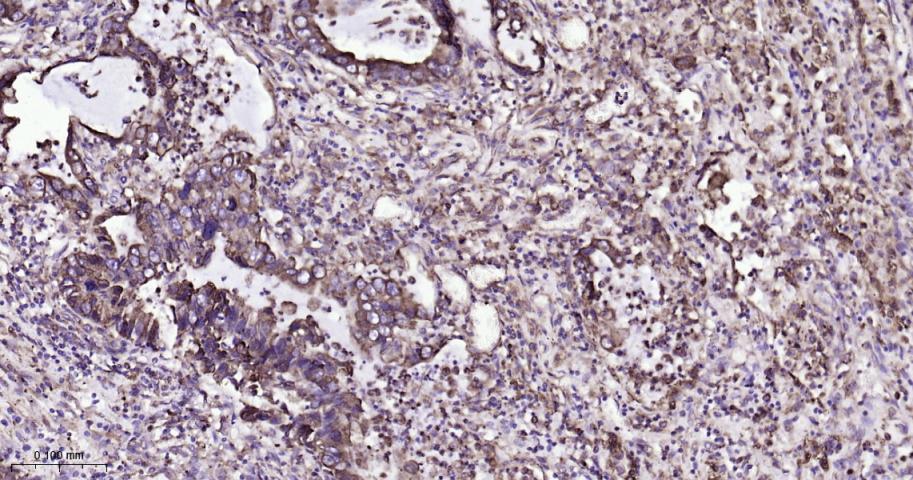 蛋白质二硫键异构酶重组兔单抗