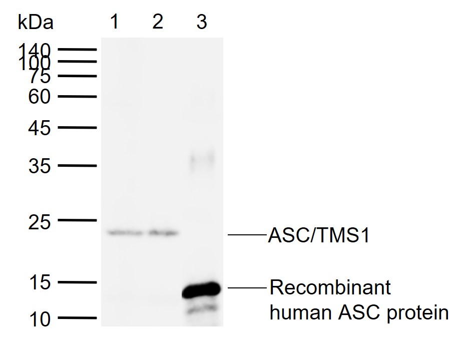 ASC/TMS1 Rabbit pAb (一抗) - WB | Bioss