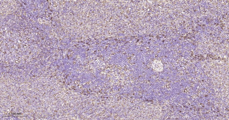 蛋白质二硫键异构酶重组兔单抗