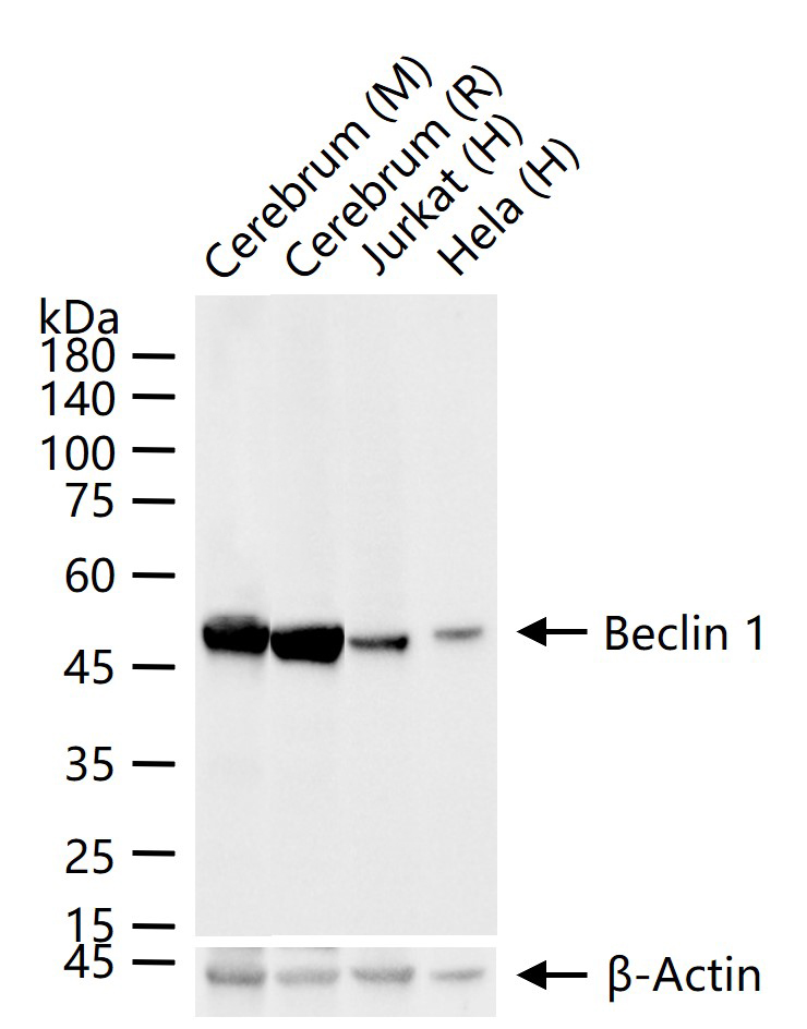 自噬效应蛋白Beclin 1重组兔单抗