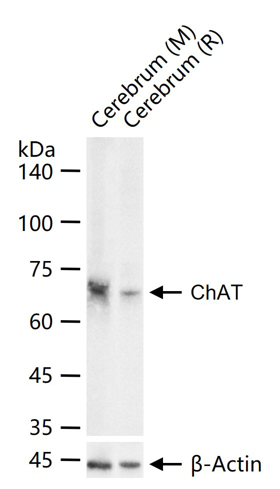 ChAT胆碱乙酰转移酶重组兔单抗