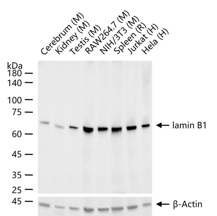 核纤层蛋白B重组兔单抗