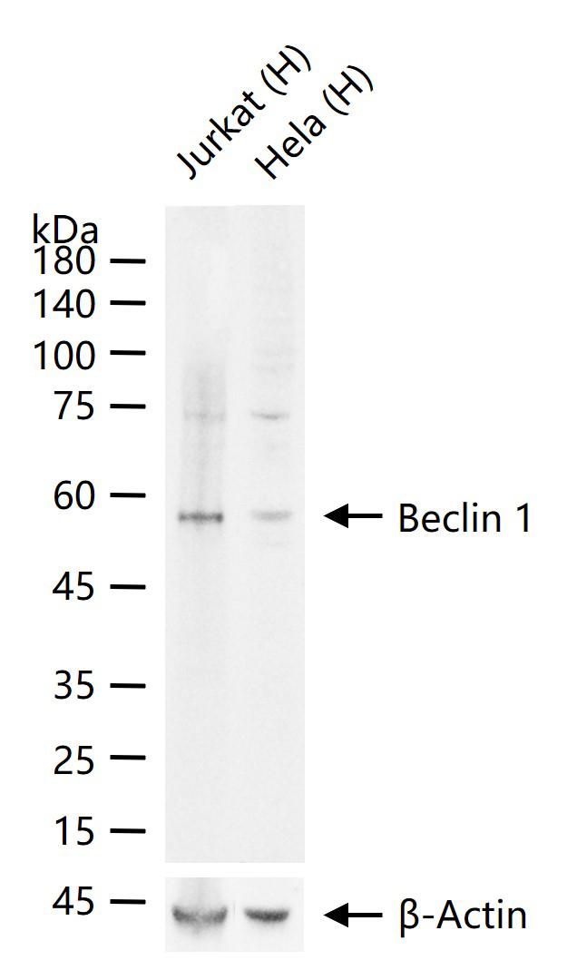 自噬效应蛋白Beclin 1重组兔单抗