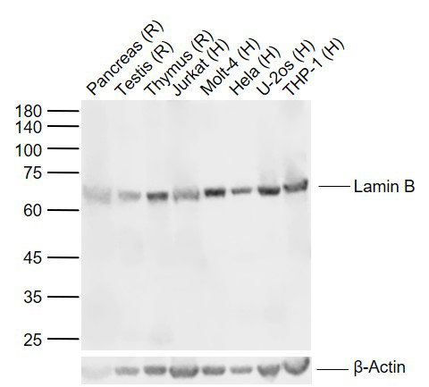 lamin B1 Mouse mAb, Nuclear Loading Control (一抗) - WB,IHC-P,IHC-F,IF | Bioss