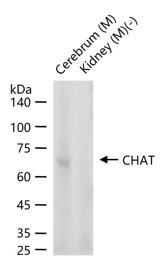 CHAT Mouse mAb (一抗) - WB,IHC-P,IHC-F,IF | Bioss