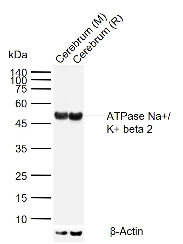 ATP1B2 Rabbit pAb (一抗) - WB | Bioss