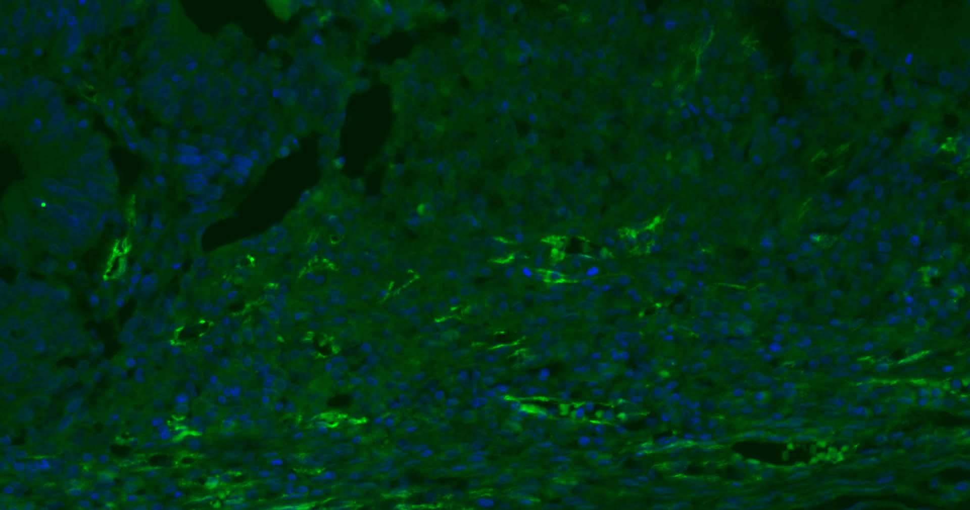 血小板内皮细胞黏附分子1单克隆抗体