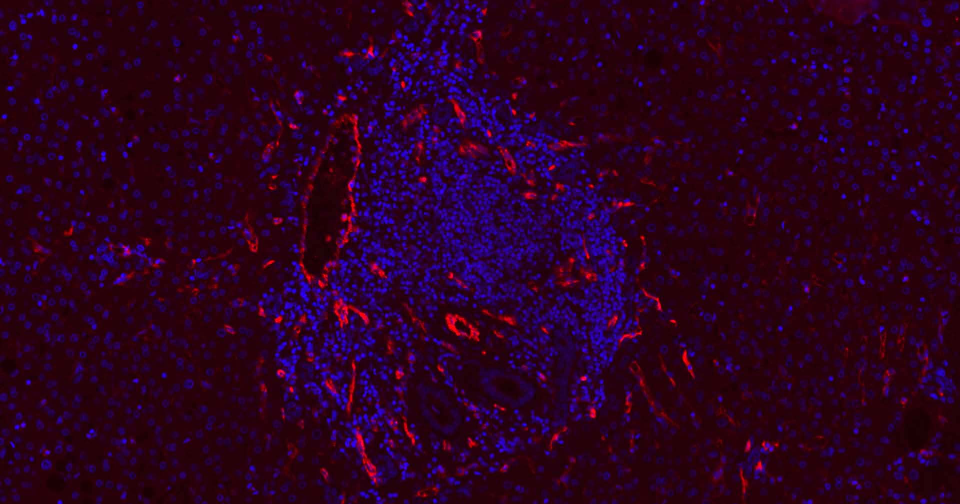 血小板内皮细胞黏附分子1单克隆抗体