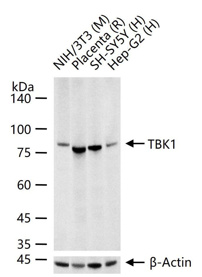 NF-κB活化激酶重组兔单抗