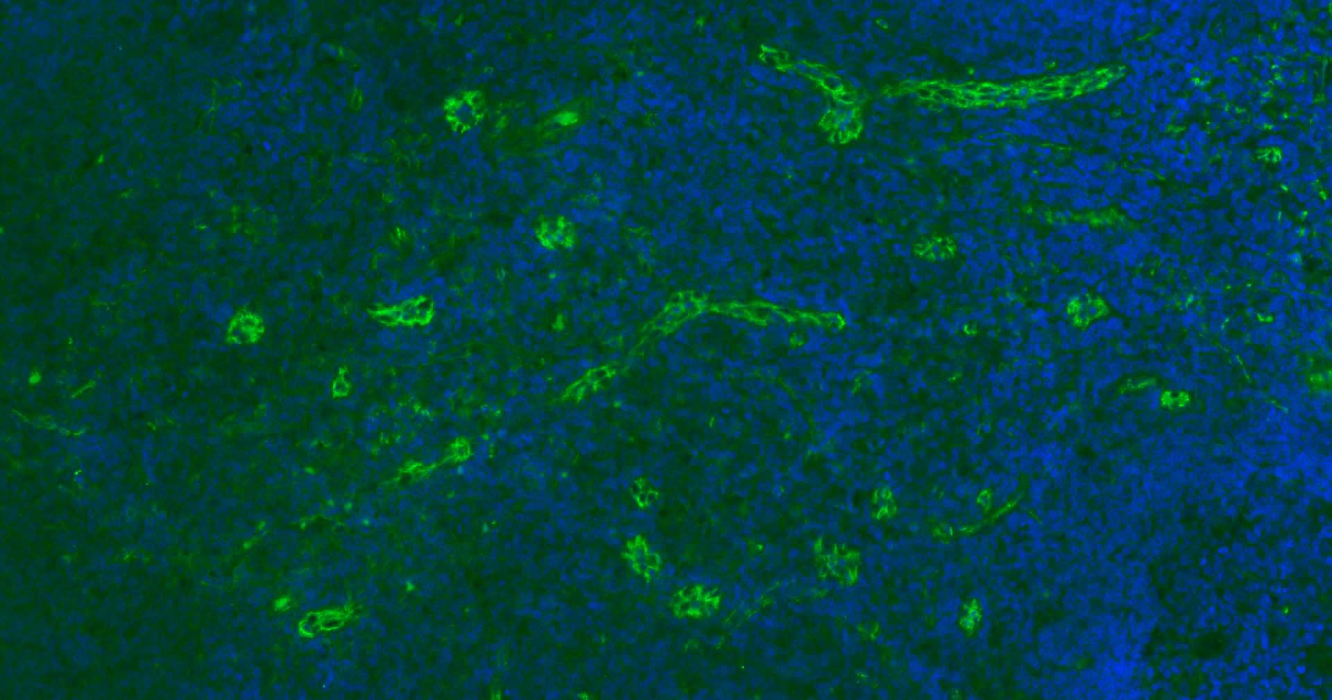 血小板内皮细胞黏附分子1单克隆抗体