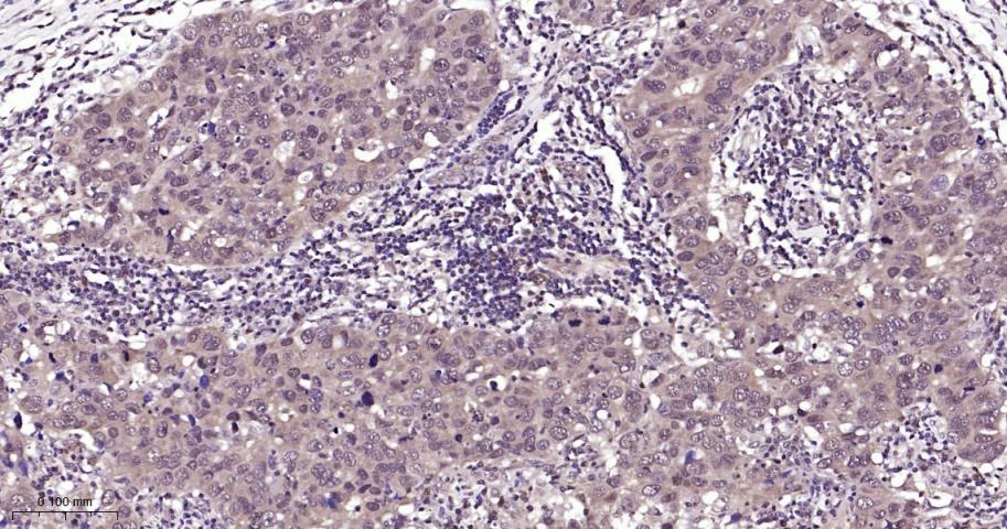 热休克蛋白71重组兔单抗-bsm-61188R