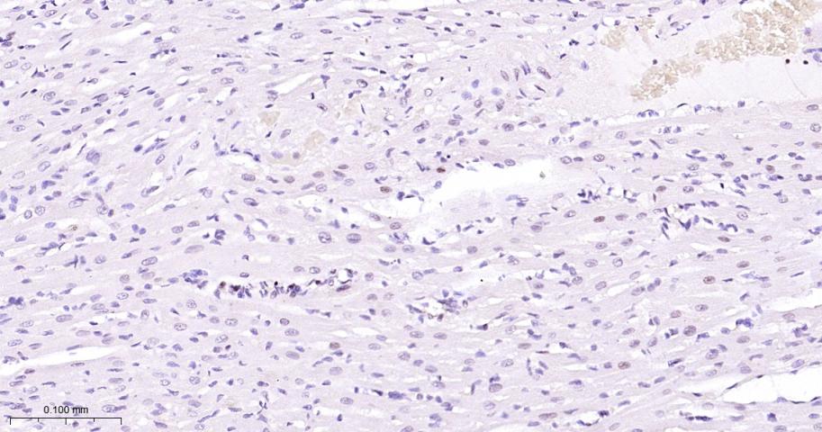 肌细胞增强因子2C重组兔单抗