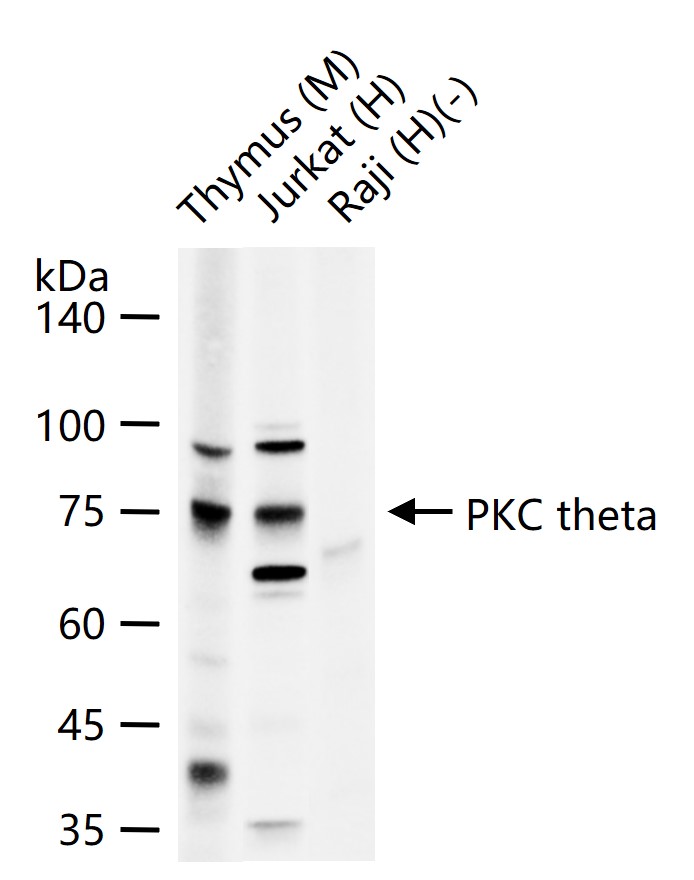 蛋白激酶C theta重组兔单抗