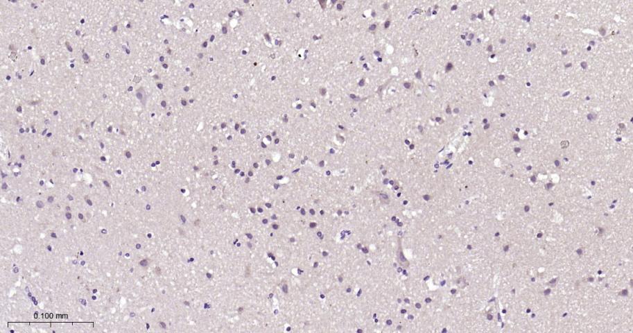 热休克蛋白71重组兔单抗-bsm-61188R