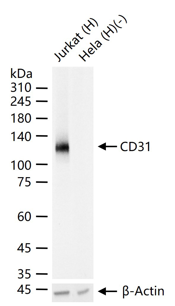 血小板内皮细胞黏附分子1重组兔单抗