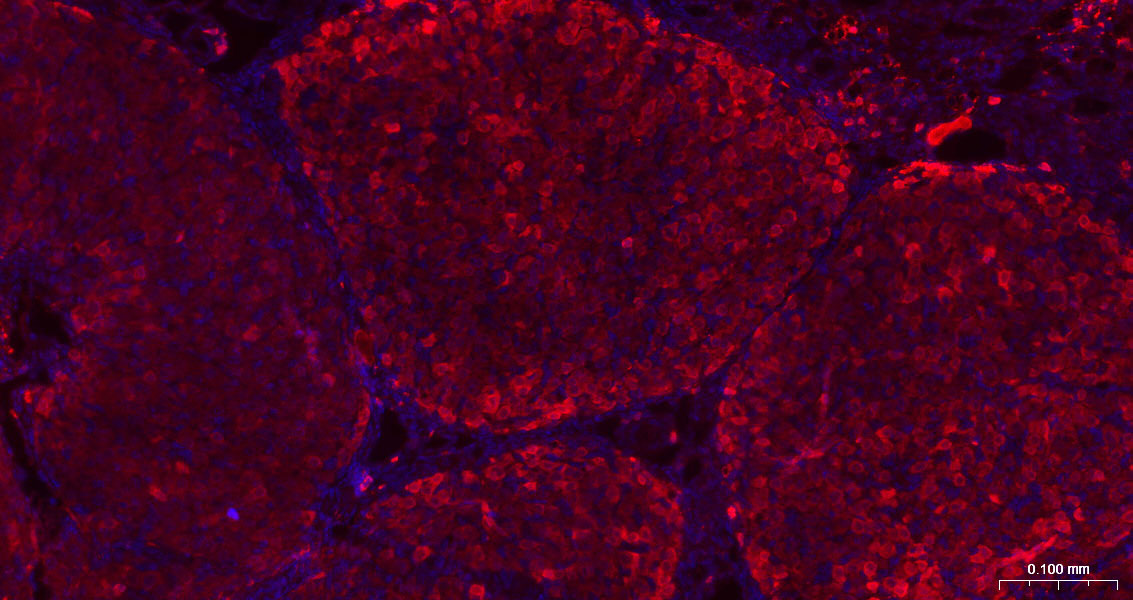 半乳糖凝集素3抗体-bs-41218R