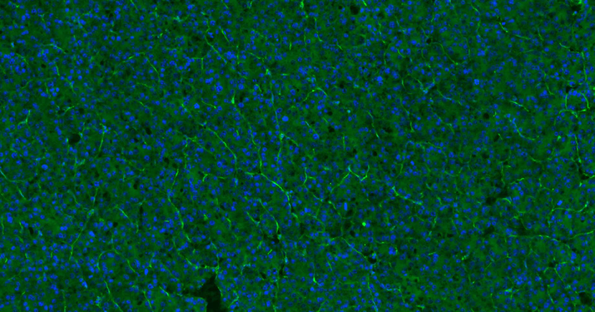 血小板内皮细胞黏附分子1单克隆抗体