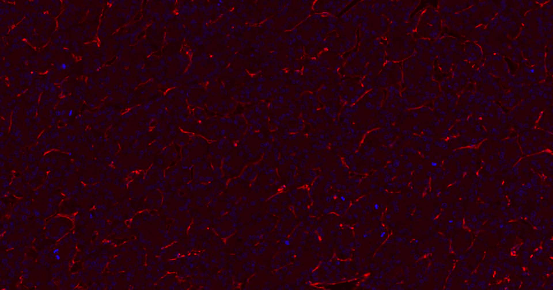 血小板内皮细胞黏附分子1单克隆抗体