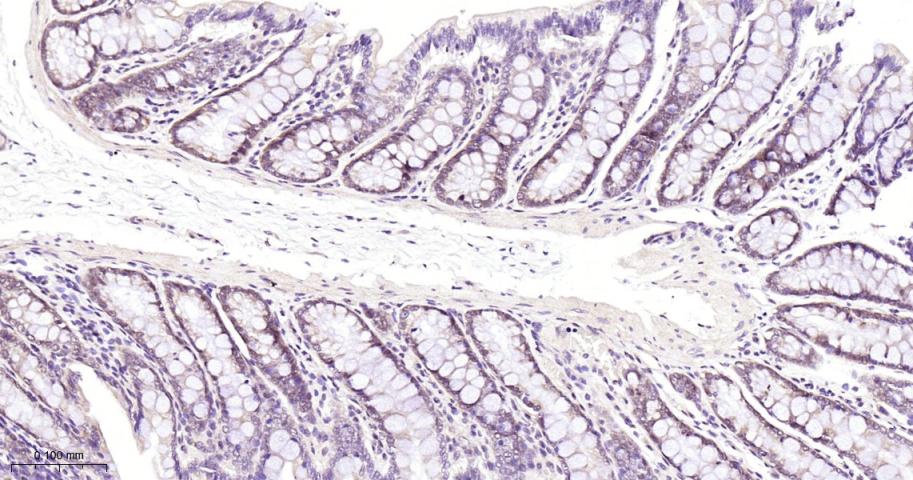 Smad4重组兔单抗