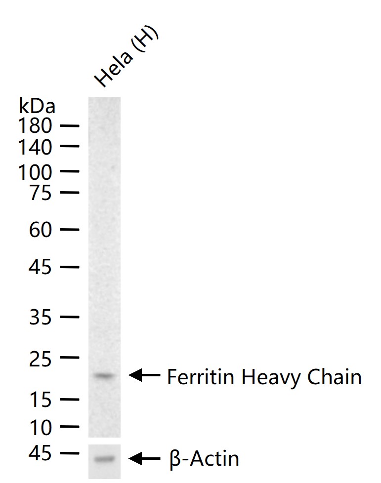铁蛋白重组兔单抗