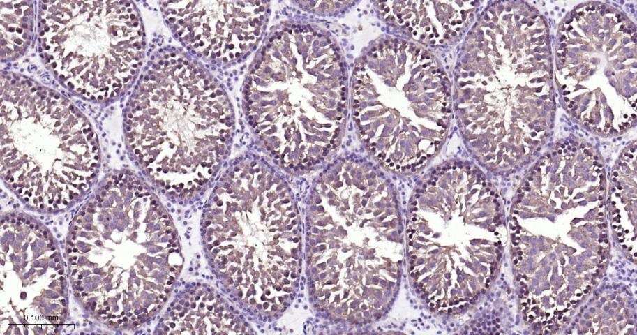 有丝分裂激酶A与重组兔单抗
